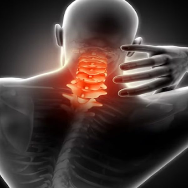 terapia cervicales